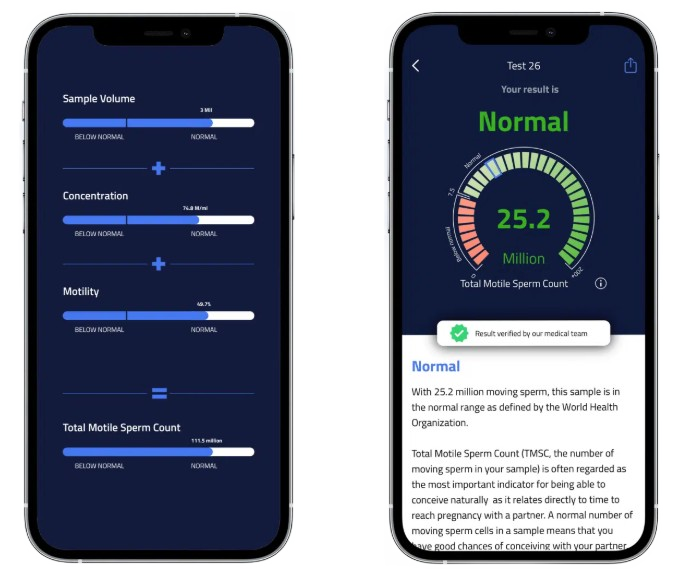 Sperm Test Results ExSeed App available at Urban TRT